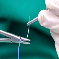 WOUND CLOSURE